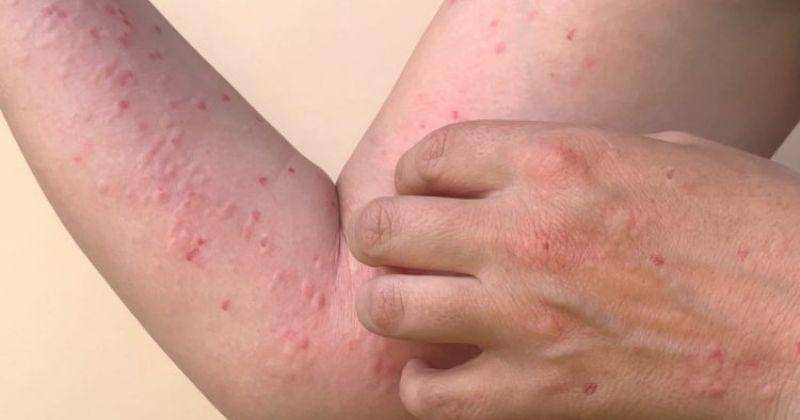 sehatnegeriku.kemkes.go.id